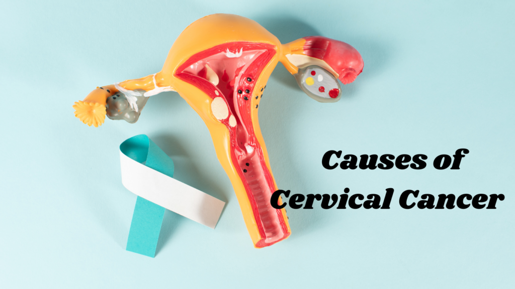 Causes of Cervical Cancer