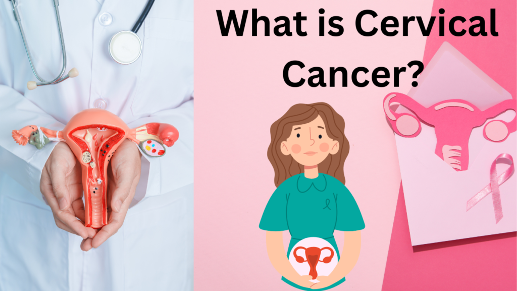 What is Cervical Cancer?